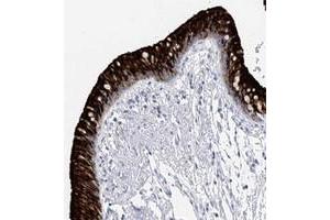 Immunohistochemical staining of human bronchus with RSHL3 polyclonal antibody  shows strong cytoplasmic and membranous positivity in respiratory epithelial cells. (RSPH4A 抗体)