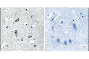 Immunohistochemistry analysis of paraffin-embedded human brain, using CDK5RAP2 Antibody. (CDK5RAP2 抗体  (AA 251-300))