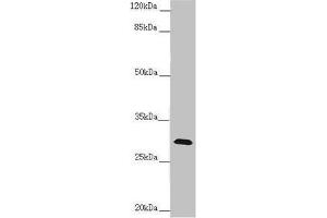 Western blot All lanes: CENPH antibody at 1. (CENPH 抗体  (AA 1-247))