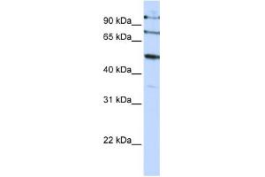 WB Suggested Anti-FBXO5 Antibody Titration:  0. (FBXO5 抗体  (C-Term))