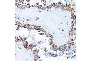 Immunohistochemistry (IHC) image for anti-Electron-Transfer-Flavoprotein, alpha Polypeptide (ETFA) (AA 1-333) antibody (ABIN6140315)
