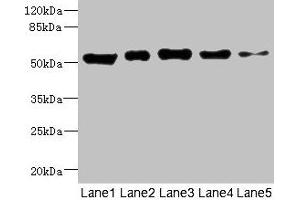 Western blot All lanes: GIPR antibody at 5. (GIPR 抗体  (AA 22-138))