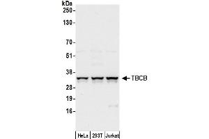 Western Blotting (WB) image for anti-Tubulin Folding Cofactor B (TBCB) (AA 75-125) antibody (ABIN7449842)