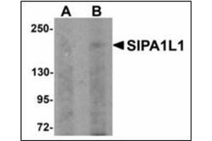 Western blot analysis of SIPA1L1 in rat brain tissue lysate with SIPA1L1 antibody at (A) 0. (SIPA1L1 抗体  (N-Term))