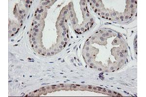 Image no. 4 for anti-Chromosome 2 Open Reading Frame 62 (C2orf62) antibody (ABIN1497053) (C2orf62 抗体)