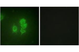 Immunofluorescence analysis of HuvEc cells, using MSK1 Antibody . (MSK1 抗体  (Internal Region))