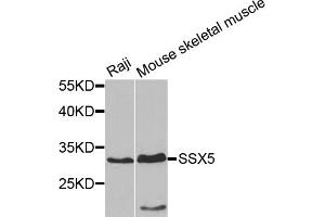 Western blot analysis of extracts of various cell lines, using SSX5 antibody. (SSX5 抗体)