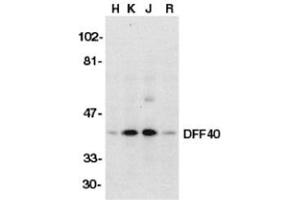 Western blot analysis of DFF40 in HeLa (H), K562 (K), Jurkat (J), and Raji (R) whole cell lysate with AP30286PU-N DFF40 antibody (I18) at 1/500 dilution. (DFFB 抗体)