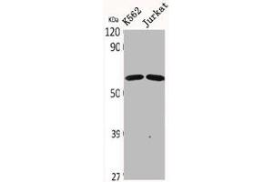 Western Blot analysis of K562 Jurkat cells using CDYL2 Polyclonal Antibody (CDYL2 抗体  (N-Term))