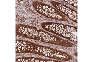 Immunohistochemical staining of human stomach with CXorf57 polyclonal antibody  shows strong nuclear, cytoplasmic and membranous positivity in glandular cells. (CXORF57 抗体)