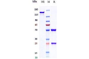 Anti-GUCY2C Reference Antibody (indusatumab) on SDS-PAGE under reducing (R) condition. (Recombinant GUCY2C (Indusatumab Biosimilar) 抗体)