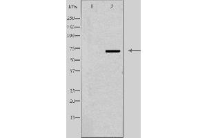 ABCD4 抗体  (Internal Region)