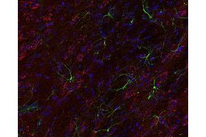 Indirect immunostaining of PFA fixed mouse brain section with anti-giantin (dilution 1 : 200; red) and mouse anti-GFAP (, dilution 1 : 200; green).