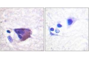 Immunohistochemistry analysis of paraffin-embedded human brain, using Kv2.