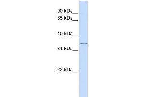 WB Suggested Anti-KCNRG Antibody Titration:  0. (KCNRG 抗体  (Middle Region))