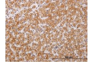 Immunoperoxidase of monoclonal antibody to RIPK4 on formalin-fixed paraffin-embedded human liver. (RIPK4 抗体  (AA 675-784))