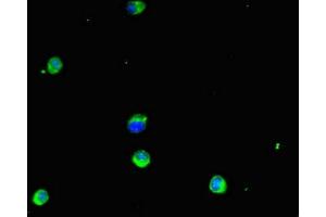 Immunofluorescent analysis of Hela cells using ABIN7154103 at dilution of 1:100 and Alexa Fluor 488-congugated AffiniPure Goat Anti-Rabbit IgG(H+L) (GSTM1 抗体  (AA 24-156))