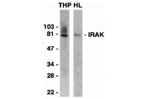 Western Blotting (WB) image for anti-Interleukin-1 Receptor-Associated Kinase 1 (IRAK1) (C-Term) antibody (ABIN1030443) (IRAK1 抗体  (C-Term))