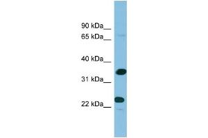 WB Suggested Anti-PDYN Antibody Titration: 0. (PDYN 抗体  (Middle Region))