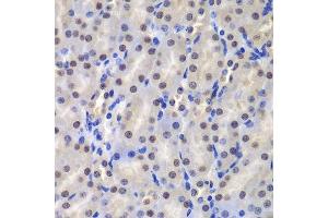 Immunohistochemistry (Paraffin-embedded Sections) (IHC (p)) image for anti-Glutathione S-Transferase pi 1 (GSTP1) (AA 1-210) antibody (ABIN6141480)