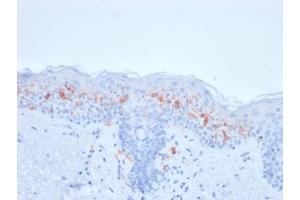 IHC testing of FFPE human skin with recombinant CD1a antibody (clone rC1A/711). (CD1a 抗体)