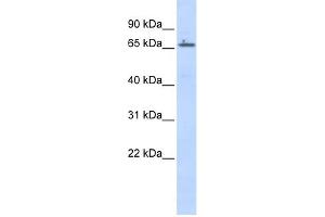 WB Suggested Anti-ZNF503 Antibody Titration: 0. (ZNF503 抗体  (Middle Region))