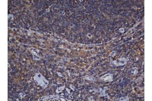 Immunohistochemistry (IHC) image for anti-Crystallin, alpha A (CRYAA) antibody (ABIN1498754)