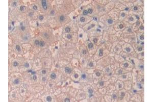 DAB staining on IHC-P; Samples: Human Liver Tissue (desert Hedgehog 抗体  (AA 241-383))