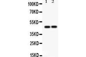 Anti- TCPTP Picoband antibody, Western blotting All lanes: Anti TCPTP  at 0. (PTPN2 抗体  (AA 1-330))