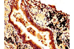 Immunohistochemistry (IHC) image for anti-SRY (Sex Determining Region Y)-Box 2 (SOX2) (AA 1-317) antibody (ABIN7172615)