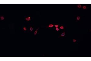 ABIN6266587 staining HeLa  cells by IF/ICC. (MCM5 抗体  (N-Term))
