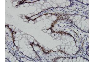 Immunostaining (ISt) image for anti-Transcription Factor 7-Like 2 (T-Cell Specific, HMG-Box) (TCF7L2) (AA 490-596) antibody (ABIN520778)