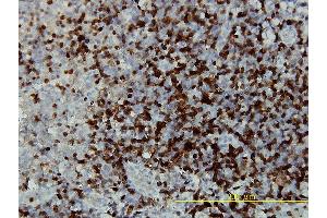 Immunoperoxidase of monoclonal antibody to CAMK4 on formalin-fixed paraffin-embedded human tonsil tissue. (CAMK4 抗体  (AA 1-473))