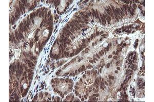 Image no. 1 for anti-Von Hippel-Lindau Tumor Suppressor, E3 Ubiquitin Protein Ligase (VHL) antibody (ABIN1501712) (VHL 抗体)
