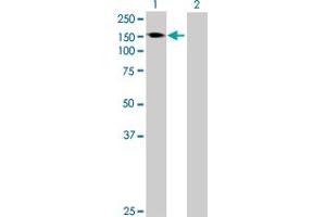 Western Blot analysis of AKAP1 expression in transfected 293T cell line by AKAP1 MaxPab polyclonal antibody. (AKAP1 抗体  (AA 1-903))