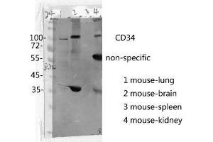 Western Blot (WB) analysis: Please contact us for more details. (CD34 抗体  (Internal Region))