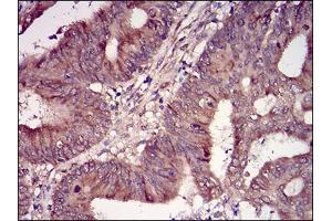 Fig. (CSNK2B 抗体  (AA 1-215))