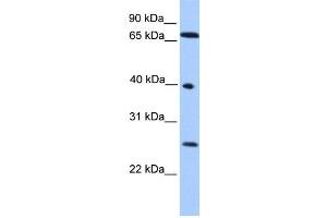 WB Suggested Anti-L3MBTL2 Antibody Titration: 0. (L3MBTL2 抗体  (N-Term))