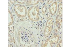 Immunohistochemistry of paraffin-embedded human kidney tissue using ABIN7149603 at dilution of 1:100 (DOCK8 抗体  (AA 1900-2099))