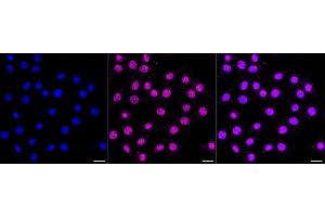 Immunocytochemical staining of C2C12 cells with Histone H4 (mono methyl K20) antibody (ABIN7798981), 1:1,000). (Recombinant Histone H4 抗体  (H4K20me1))
