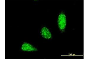 Immunofluorescence of monoclonal antibody to TRIM31 on HeLa cell. (TRIM31 抗体  (AA 1-100))