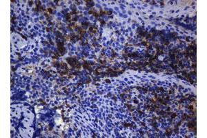 Immunohistochemistry (IHC) image for anti-T-cell surface glycoprotein CD1c (CD1C) antibody (ABIN2670676) (CD1c 抗体)