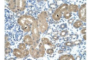 TRNT1 antibody was used for immunohistochemistry at a concentration of 16. (Trnt1 抗体  (N-Term))