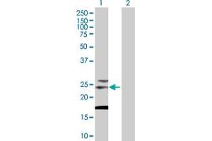 Western Blot analysis of TSPAN31 expression in transfected 293T cell line by TSPAN31 MaxPab polyclonal antibody. (TSPAN31 抗体  (AA 1-210))