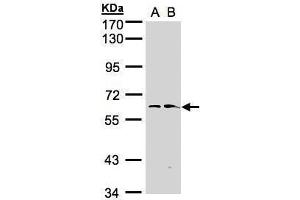 WB Image Sample(30 ug whole cell lysate) A:Hep G2 , B:Raji , 7. (FMO1 抗体)