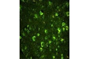 Immunofluorescence (IF) image for anti-Abl-Interactor 1 (ABI1) antibody (ABIN3003792) (ABI1 抗体)