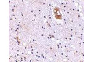 Immunohistochemistry of EVER2 in human brain with EVER2 antibody at 5 μg/ml. (TMC8 抗体  (Center))