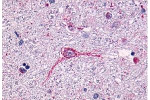 Anti-NTSR1 antibody  ABIN1049154 IHC staining of human brain, neurons and glia. (NTSR1 抗体  (N-Term))