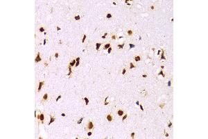 Immunohistochemistry of paraffin-embedded Mouse brain using Histone H3 antibody at dilution of 1:100 (x400 lens).