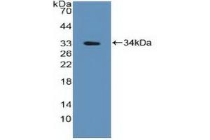 Western Blotting (WB) image for anti-Protein tyrosine Phosphatase, Non-Receptor Type 2 (PTPN2) (AA 1-257) antibody (ABIN7444958)